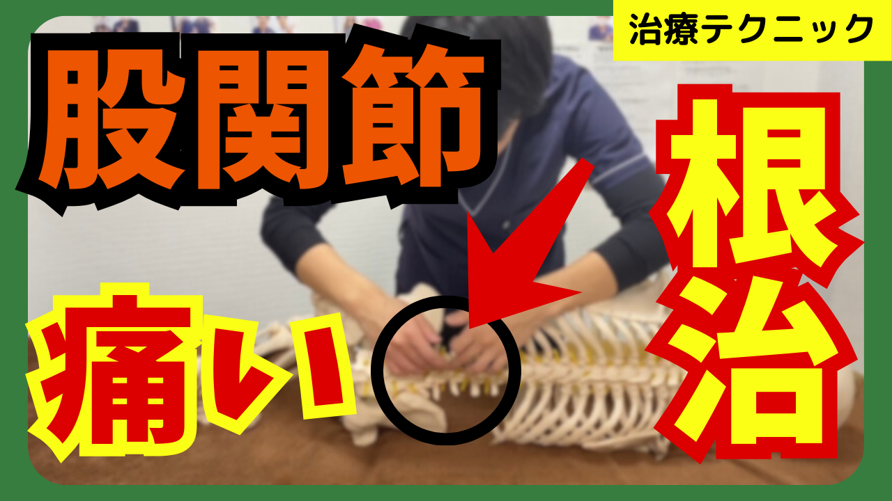 股関節の痛みの原因は”多裂筋”だった！？治療テクニックについてご紹介！！